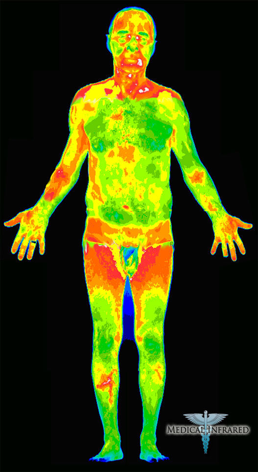 thermal infrared